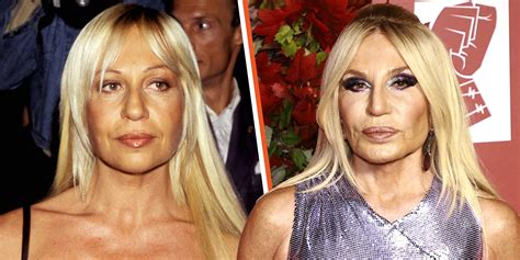 donna versace lifting|Donatella Versace .